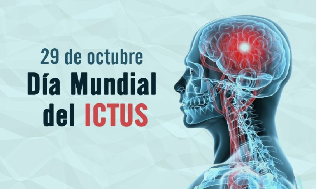 28 octubre: dia mundial del ictus